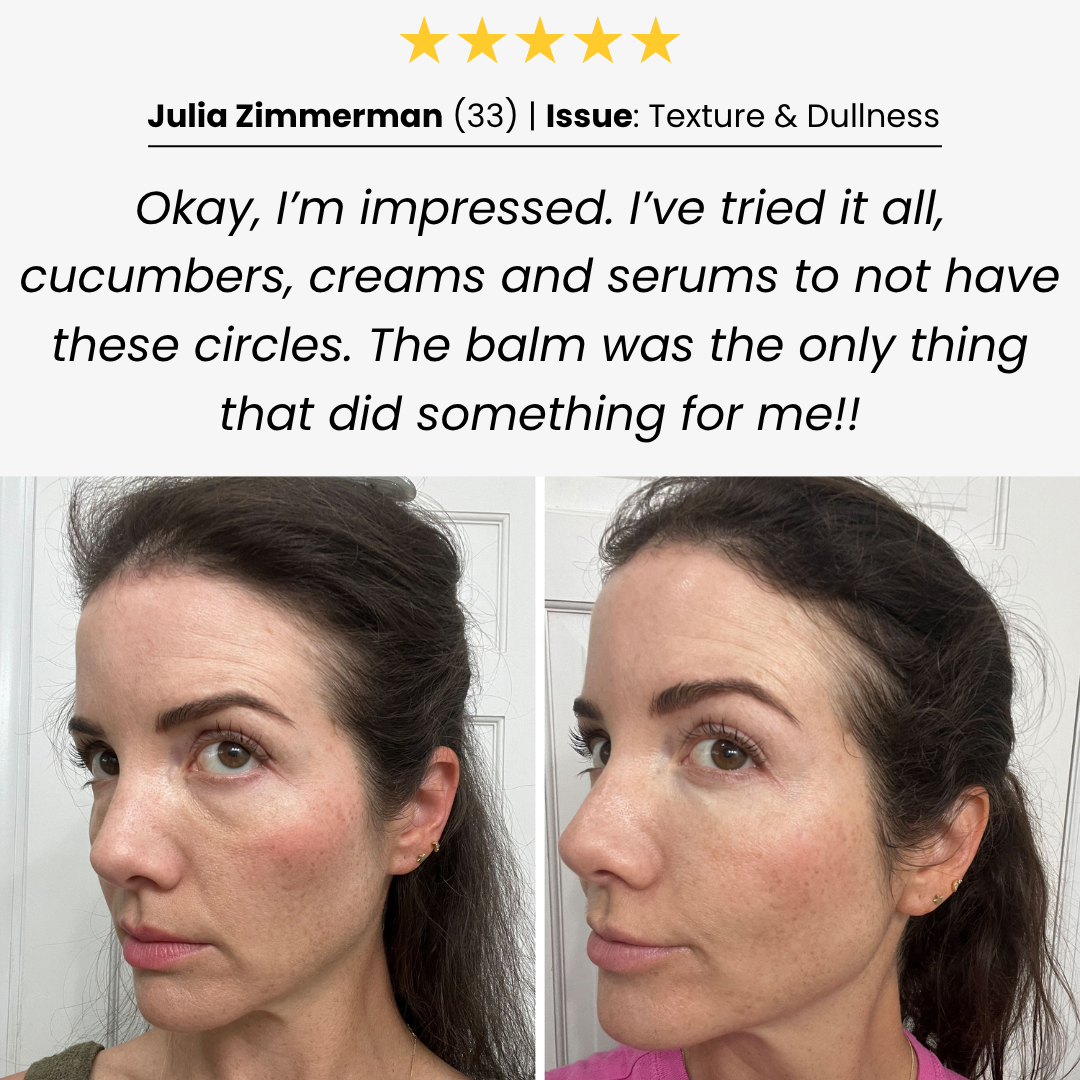 Tallow & Honey Eye Balm - Dark Circle Eraser