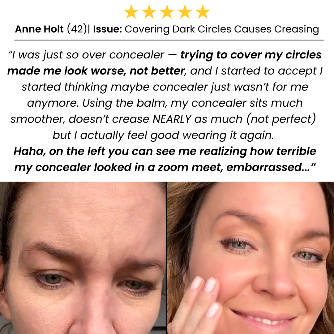 Tallow & Honey Eye Balm - Prevents Under-Eye Creasing